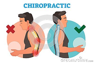 Chiropractic conceptual vector illustration with back bone curvature. Vector Illustration