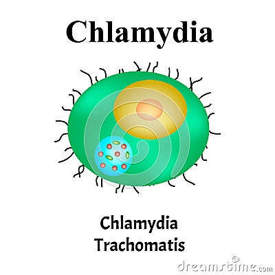 Chlamydia trachomatis. Bacterial infections Chlamydiosis. Sexually transmitted diseases. Infographics. Vector Vector Illustration