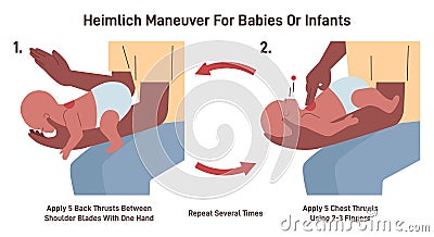 Choking first aid. Heimlich maneuver procedure to remove a foreign Vector Illustration