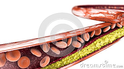 Cholesterol formation, fat. 3d section of an artery, vein and red blood cells, heart Stock Photo