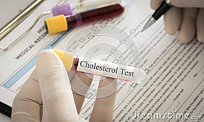 Cholesterol test Stock Photo