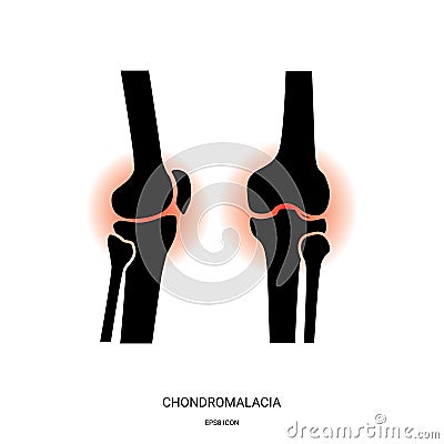 Chondromalacia and Knee Joint Icon Vector Illustration