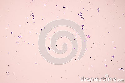Chromosomes Human under the microscope. Stock Photo