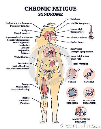 Chronic fatigue syndrome with symptom and risk factors list outline diagram Vector Illustration