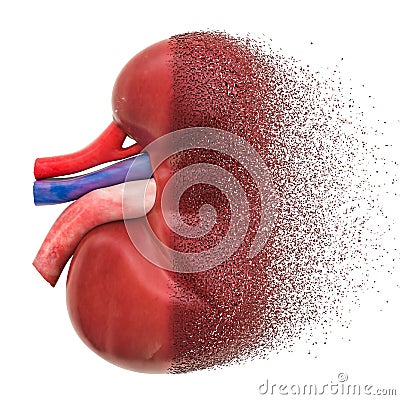 Chronic kidney disease, kidney failure concept. 3D rendering Stock Photo