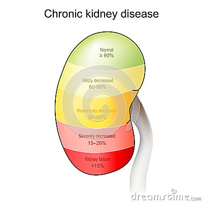 Chronic kidney disease. Stage of disorder Vector Illustration