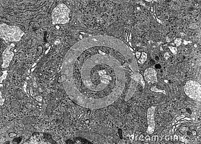 Chylomicrons. Intestinal cells Stock Photo