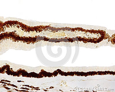 Eye. Ciliary body epithelium Stock Photo