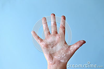 Clean hands concept. Hygiene and health concept.Hand washing.Coronavirus epidemic warning. Children`s hands close-up Stock Photo