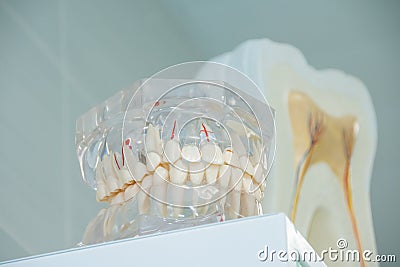 Clean teeth denture, dental cut of the tooth, tooth model, and dentistry instruments in dentist`s office. Stock Photo