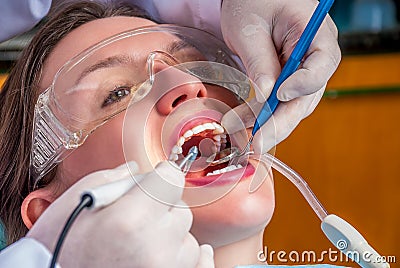 Cleaning the teeth Stock Photo