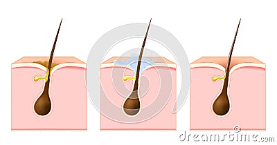 Cleanse the skin pores and hair Vector Illustration