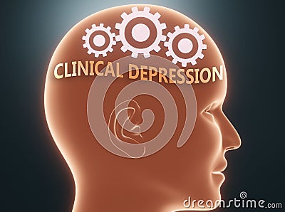 Clinical depression inside human mind - pictured as word Clinical depression inside a head with cogwheels to symbolize that Cartoon Illustration