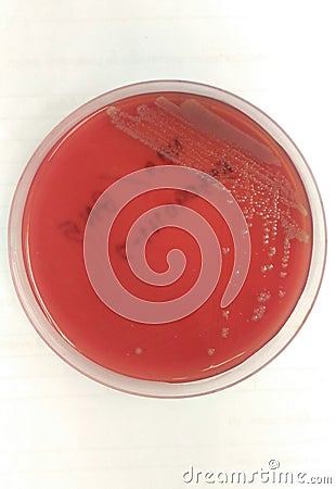 Close up agar plate and biochem test. Stock Photo