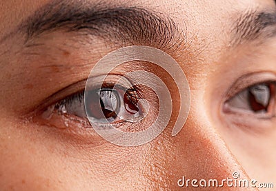 Close up of Asian woman crying with tear and little freckles on her beautiful face Stock Photo