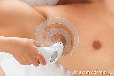 Close-up Of Beautician Giving Laser Epilation Treatment Stock Photo