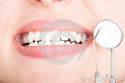 Close-up of beautiful white teeth with dentist tools Stock Photo