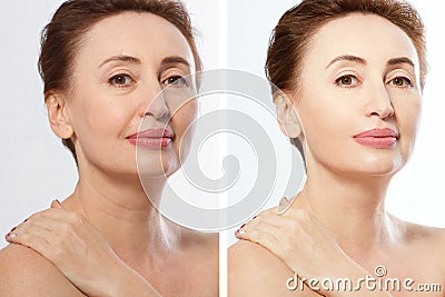 Close up before after Beauty middle age woman face portrait. Spa and anti aging concept Isolated on white background. Plastic Stock Photo