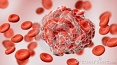 Close-up of a coagulated clot of red blood cells entangled in fibrin 3D rendering illustration. Thrombus, thrombosis, blood Cartoon Illustration