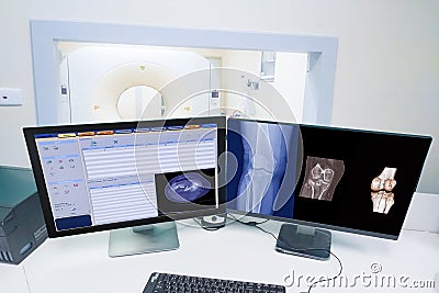 Close up Computer monitor Scan control room and computer showing knee scan fracture, Medical technology concept Stock Photo