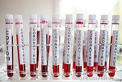 Close-Up on 19 Vaccine on Laboratory Tube Stock Photo
