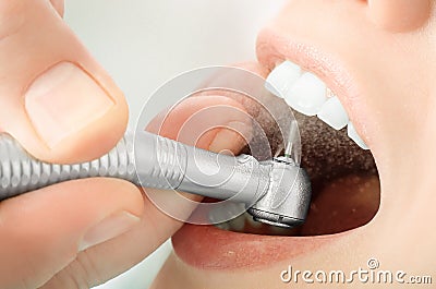 Close up of dentist hand drilling the teeth and spraying the water Stock Photo