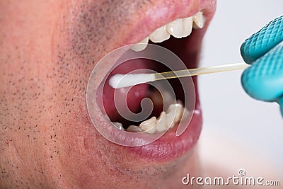 Dentist Making Saliva Test On The Mouth With Cotton Swab Stock Photo