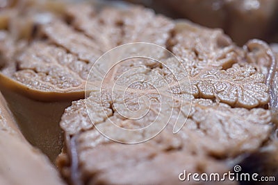 Close-up detail of the surface of the cerebellum Stock Photo