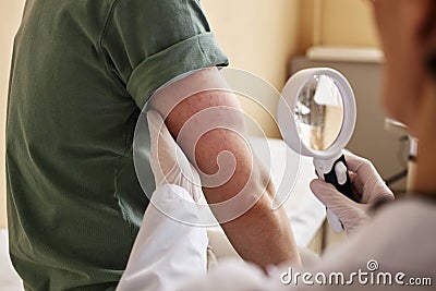 Close up of doctor inspecting skin with magnifying glass Stock Photo