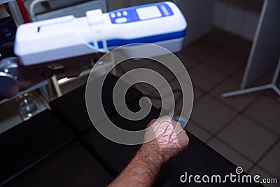 Close-up a doctor`s hand in a sterile office demonstrates the operation of a scanner for veins, medical equipment. The Stock Photo