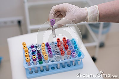 Close-up of doctor wearing medical glove taking tubes for blood test. Editorial Stock Photo