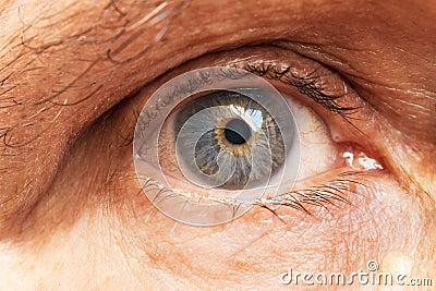 Close-up of an elderly persons blue eye with a golden loop around the iris Stock Photo