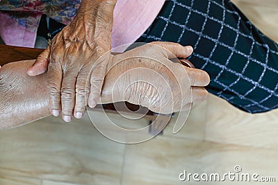 Elderly swollen hand or edema hand Stock Photo