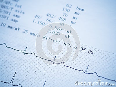 Close up of an electrocardiogram. Stock Photo