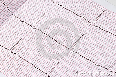 Close up of an electrocardiogram in paper form, medical healthcare. Stock Photo