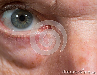 Close up of eye senior caucasian man Stock Photo