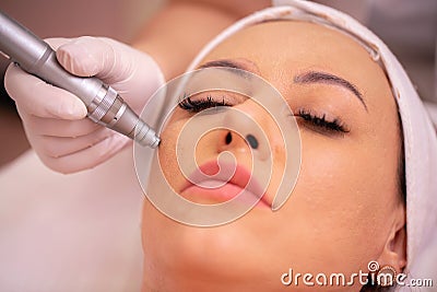 Close up of facial treatment with acupuncture pen Stock Photo