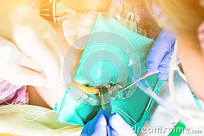 Female dentist treat teeth Stock Photo