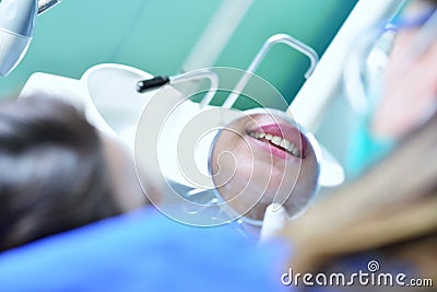 Close-up of female with open mouth during oral checkup at the dentist. Stock Photo