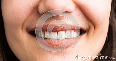 Close-up of female teeth smile Stock Photo