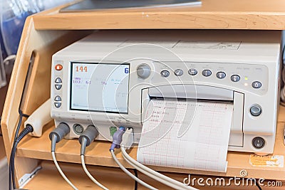 Close-up fetal monitor with baby heart beats at labor room hospital Stock Photo