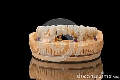 Close-up front view of a dental lower jaw prosthesis on black glass background. Artificial jaw with veneers and crowns Stock Photo