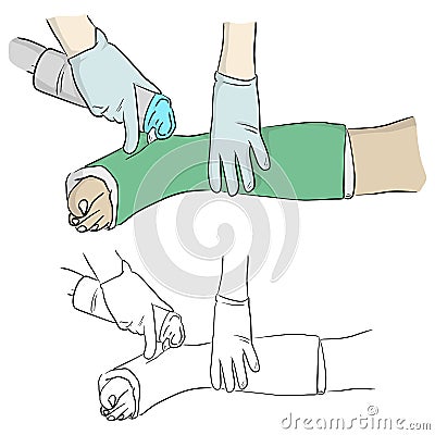 Close-up hand cutting plaster cast at leg and foot patient to immobilize after fracture injury vector illustration sketch doodle Vector Illustration