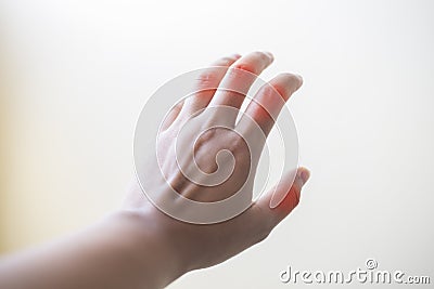 Close up hand rheumatoid arthritis pateint. Stock Photo