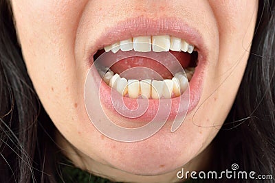 Close up of healthy teeth of young woman. Dental health care. Hygiene teeth. Dentistry Stock Photo