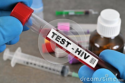 HIV test in close-up Stock Photo