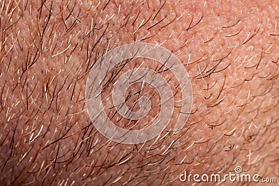 Close-up of human skin Stock Photo
