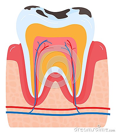 Close up of a human tooth cross section showing enamel, dentin, pulp, and gum. Dental anatomy and health care vector Vector Illustration