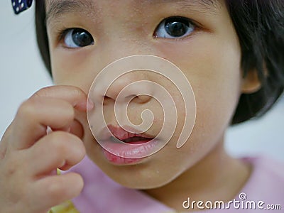 Close up of little Asian baby girl scratching on her allergic face, as it got rashes making her facial skin dry, and itchy Stock Photo