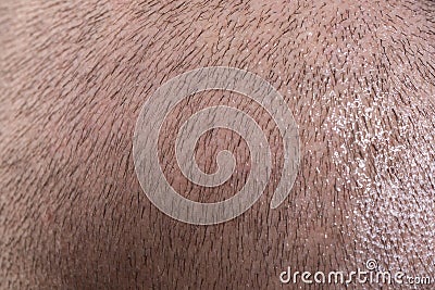 Close up male bold head. Hair close up. Short hair texture background closeup. Stock Photo